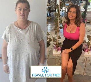 travel after gastric sleeve